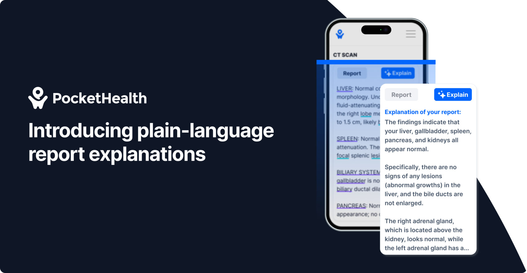 Plain-language report explanations with AI