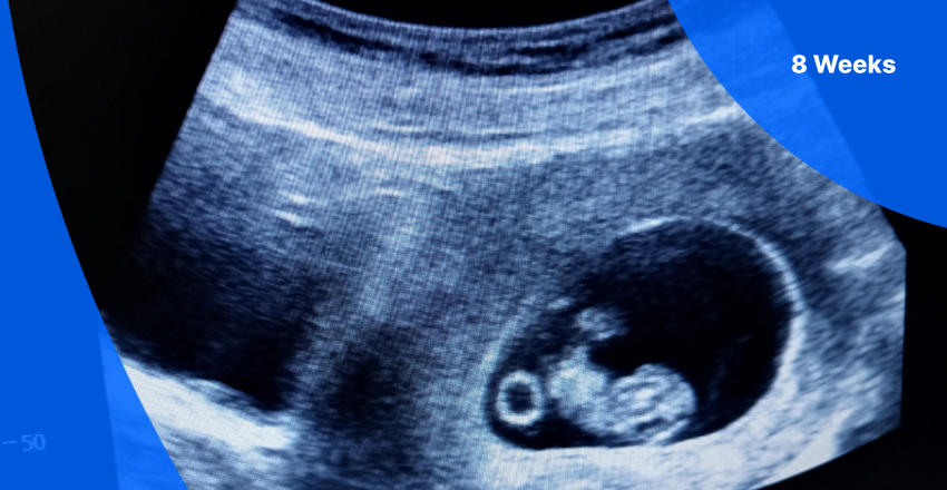 8 weeks pregnant ultrasound image