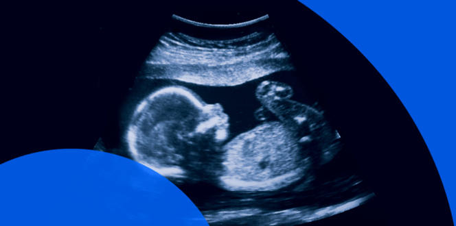 pregnancy ultrasound report