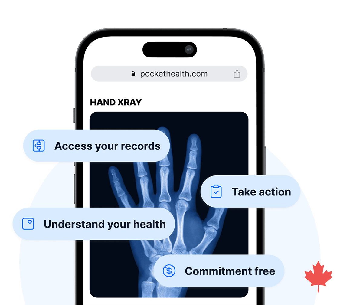 A smartphone screen shows an X-ray and text: Access your records, Take action, Understand your health and Commitment free.