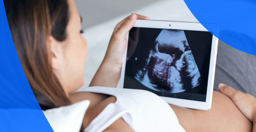 Pregnancy Ultrasound